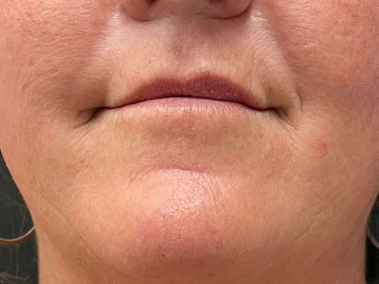 Before Image