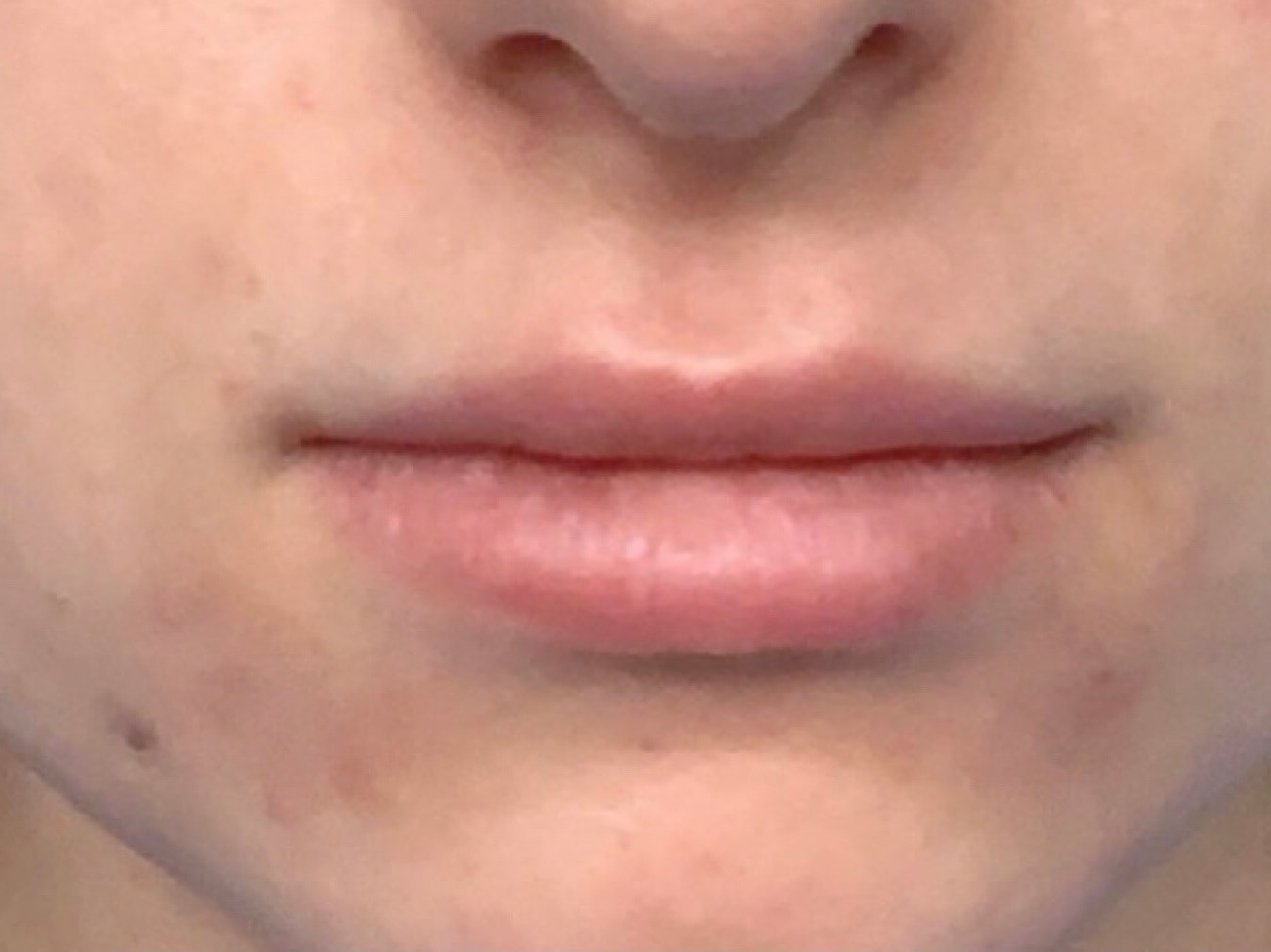 Before Image