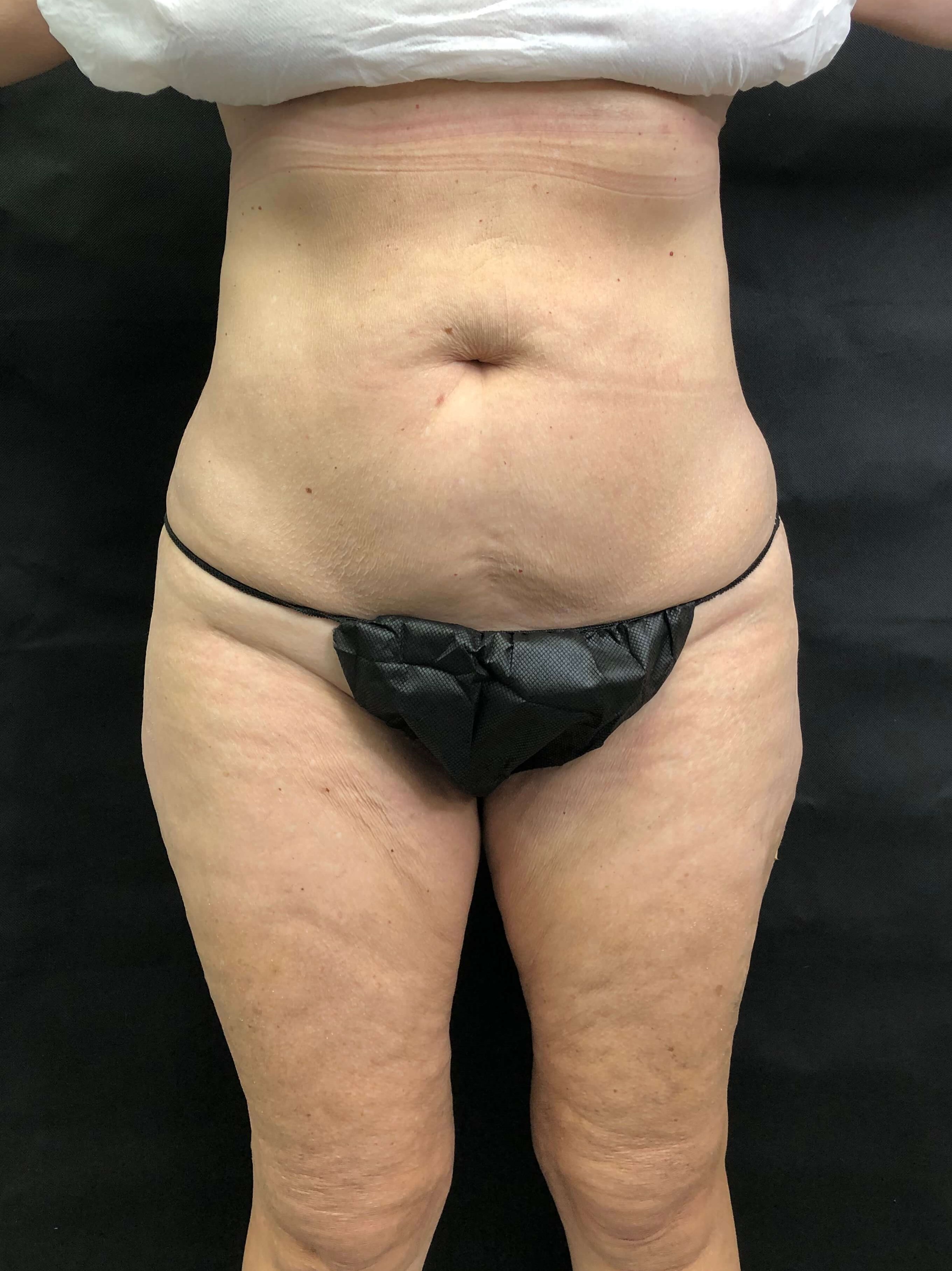 After Image