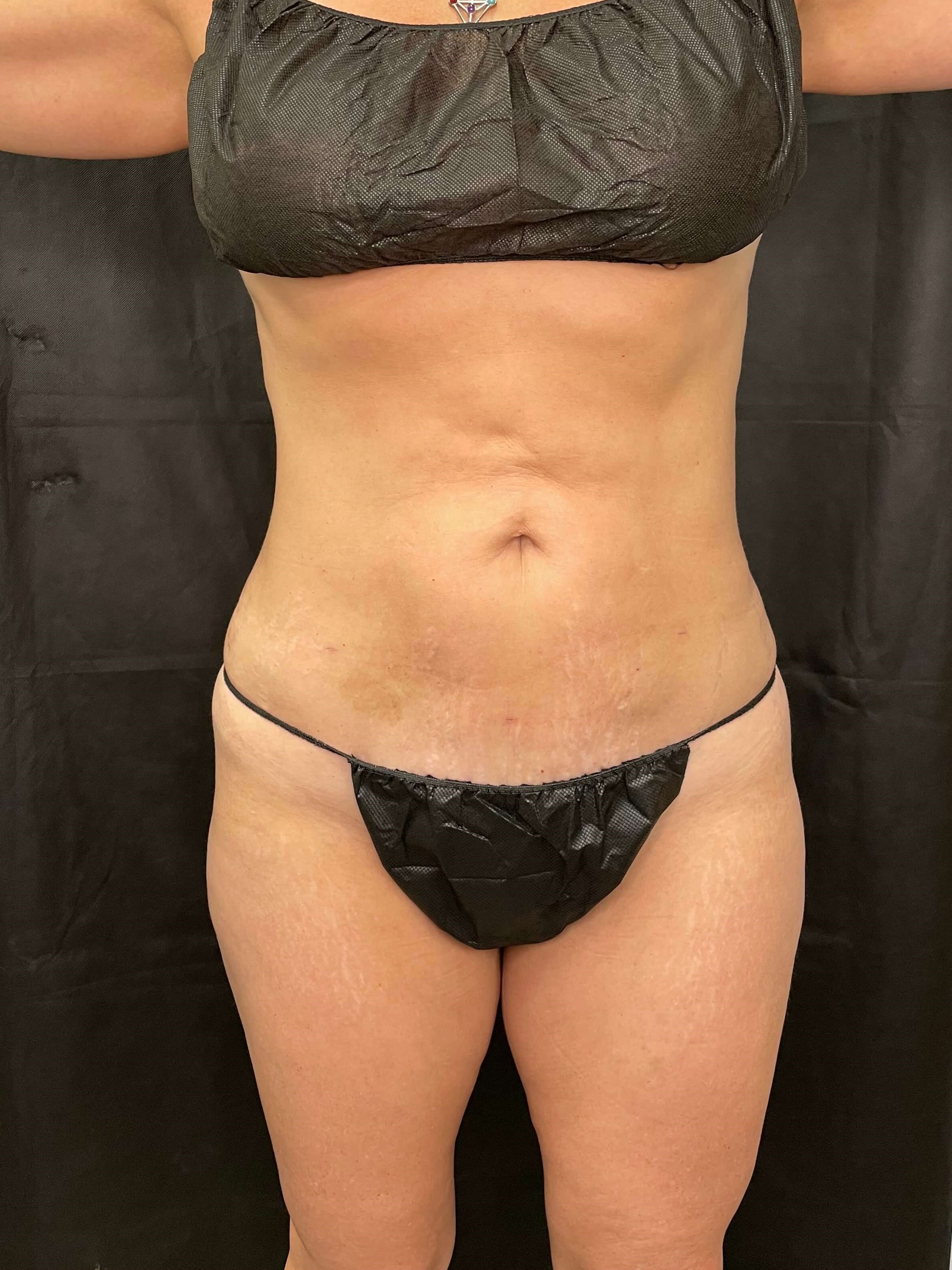 After Image