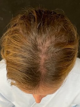 After Image