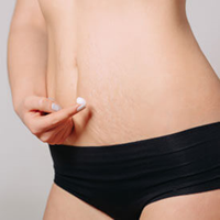 Nonsurgical Skin Tightening