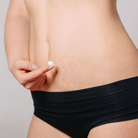Nonsurgical Skin Tightening